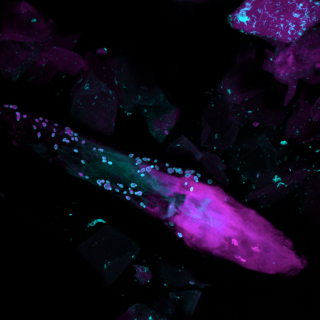 Illustration for article titled This Fungus Is Growing All Over Your Body